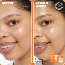 Revolution Skin Be Bright 4 Step Starter Kit Minis