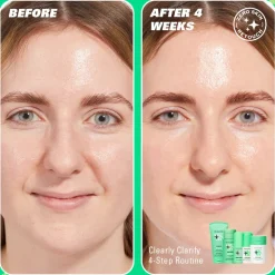 Revolution Skin Serum Supreme 10% Niacinamide Serum Clarifying Serum 30ml